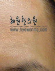 imghybaek00008.jpg