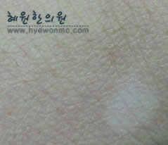 imghybaek00016e.jpg